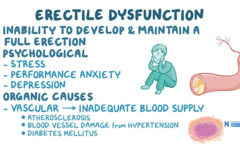 Exploring the Link Between Erectile Dysfunction and Chest Pain Unveiled by Scientists